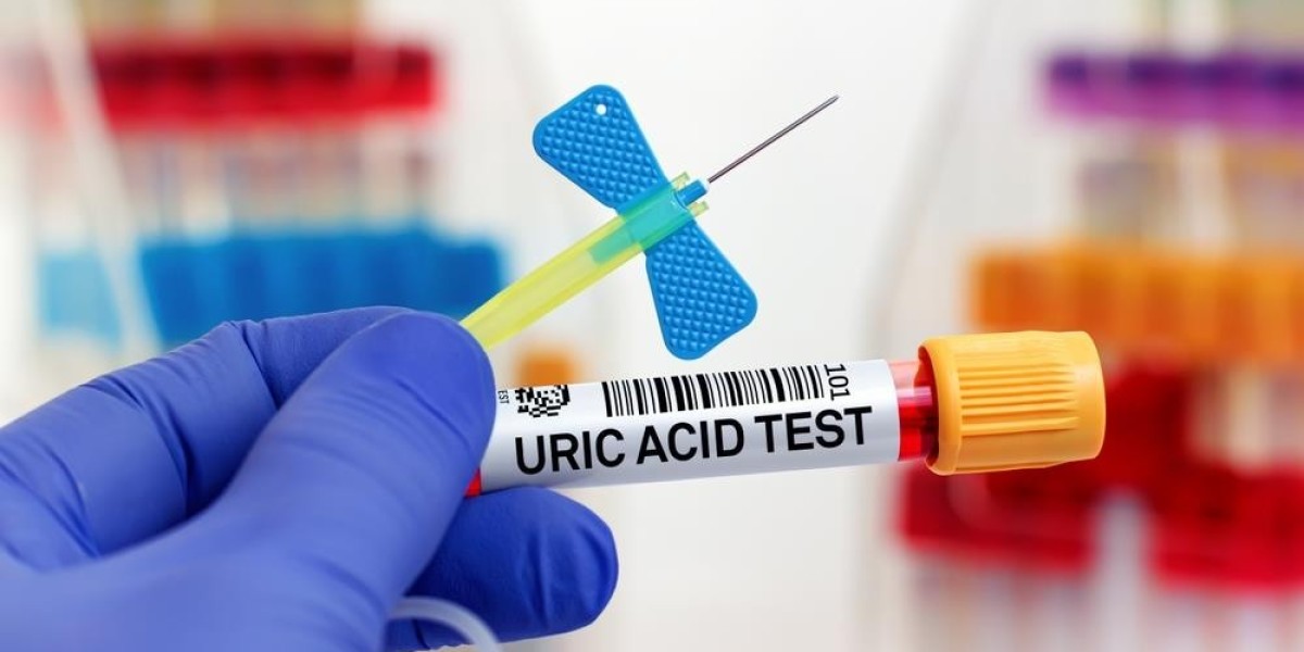 Is Fasting Required for a Uric Acid Test?