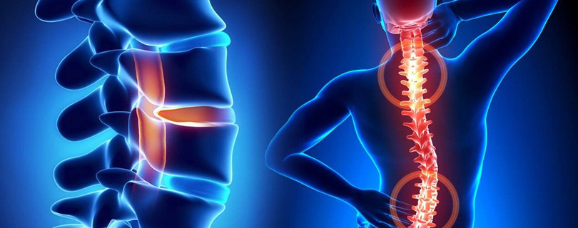 Spine Specialist in Ahmedabad: Advanced Solutions for Lasting Back Pain Relief – @tasknetworkx on Tumblr