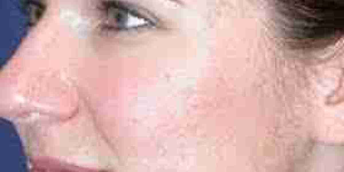 Exosome Skin Therapy in London: A New Era in Skin Regeneration