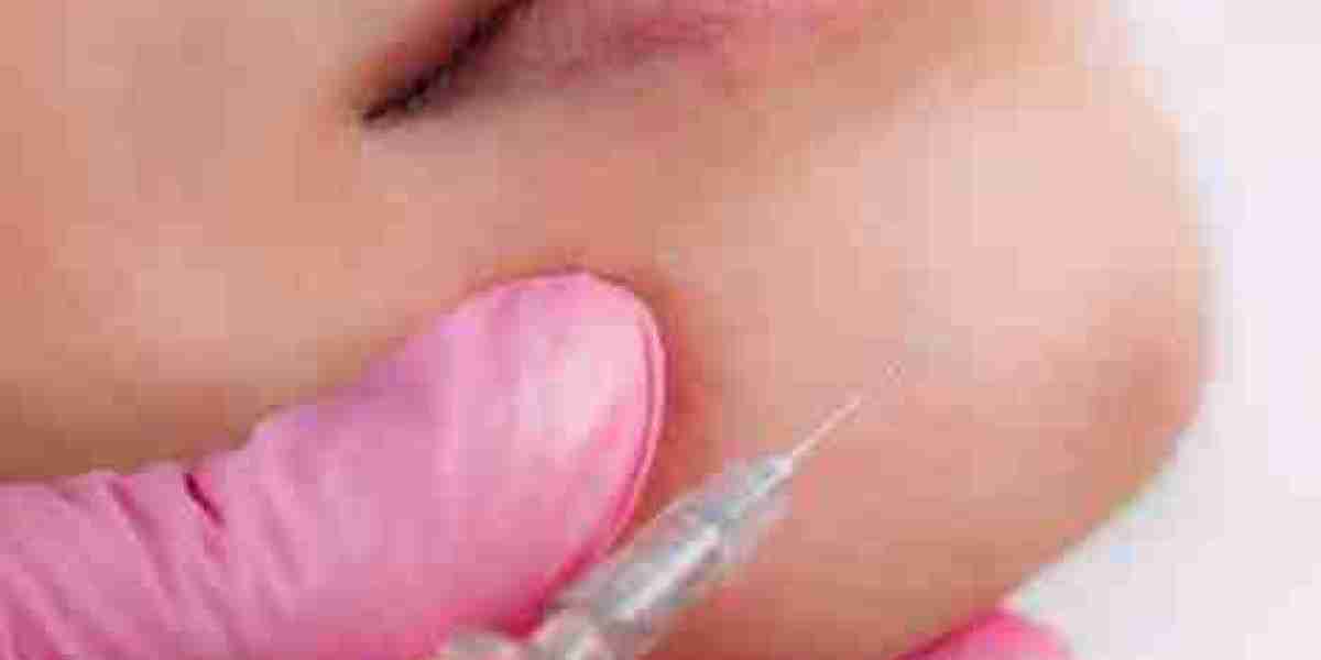 Enhancing Natural Beauty with Modern Lip Augmentation in New York City