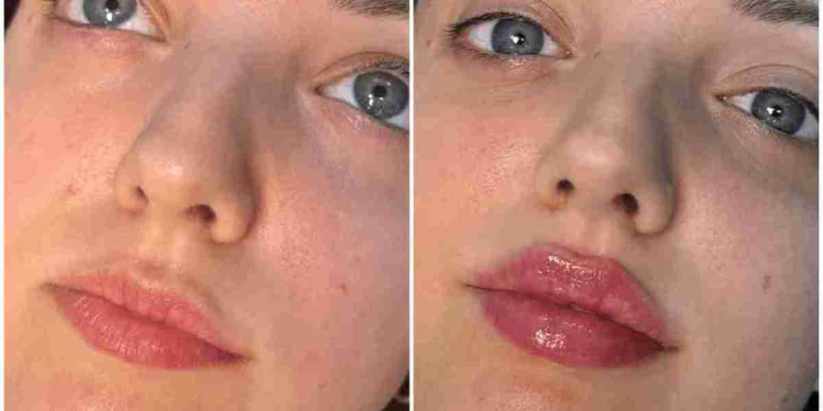 Best Plastic Surgeons in Dubai for Millennials