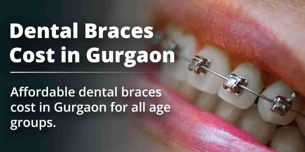 Dental Braces Cost in Gurgaon: Complete Guide by Dr. Aneesh Katyal
