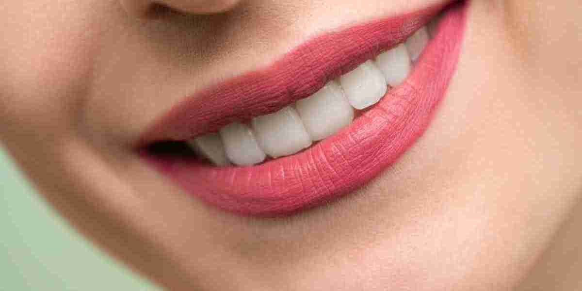 Is a Smile Makeover Worth It? Benefits Beyond Beautiful Teeth