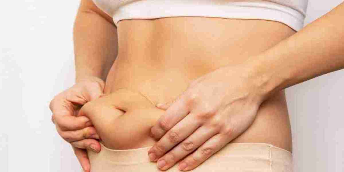 Elegant Contours from Best Liposuction Surgeon in Dubai