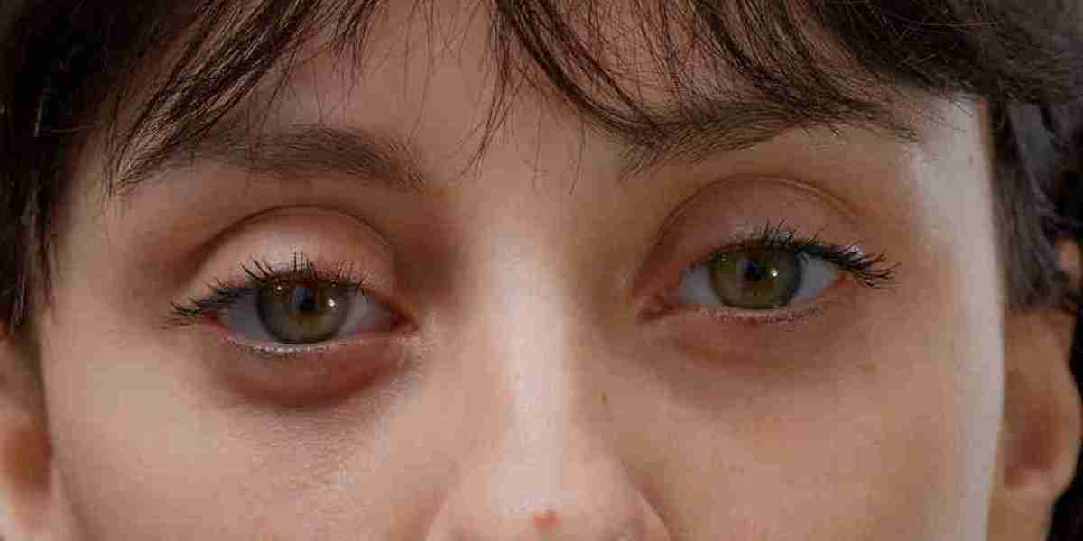 Eyelid Bag Surgery Dubai: What Happens During an Initial Consultation?