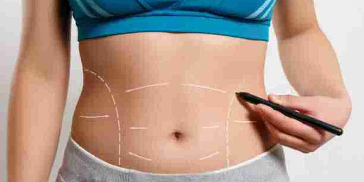 What to Know About Post-Liposuction Care in Riyadh